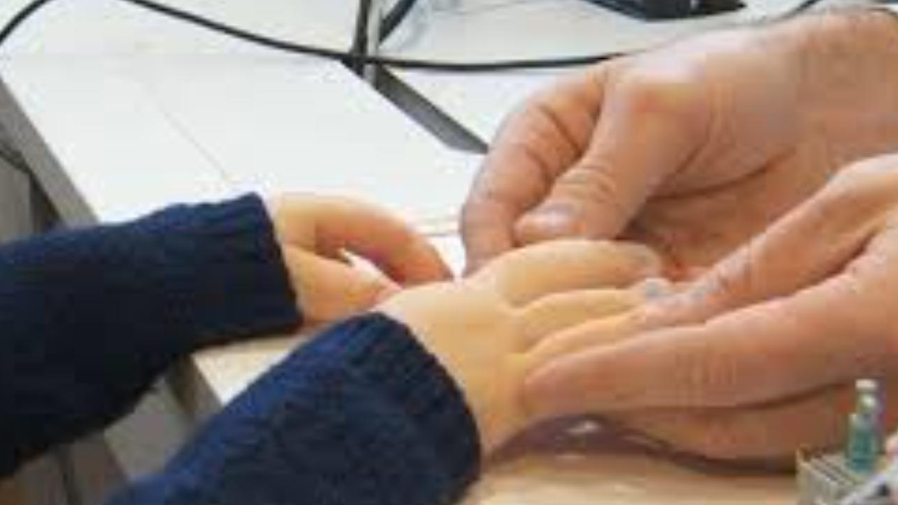 Tout ce qu’il faut savoir sur le syndrome de Cloves (Spécialiste)